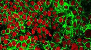 CANCER-VANISHED-IN-DRUGTRIAL-ACCORDING-TO-NEWYORK-TIMES